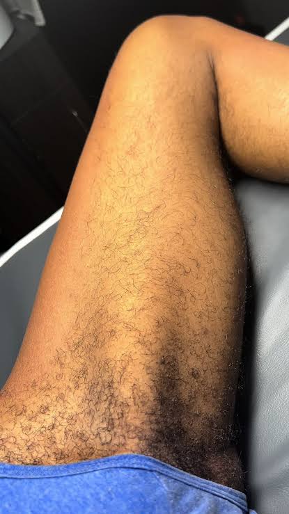 Inner Thigh