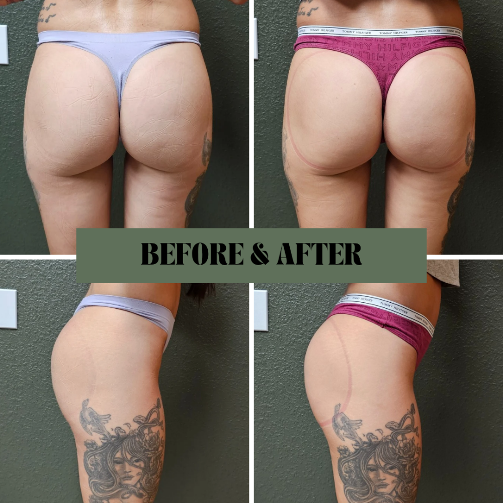 Booty Goals