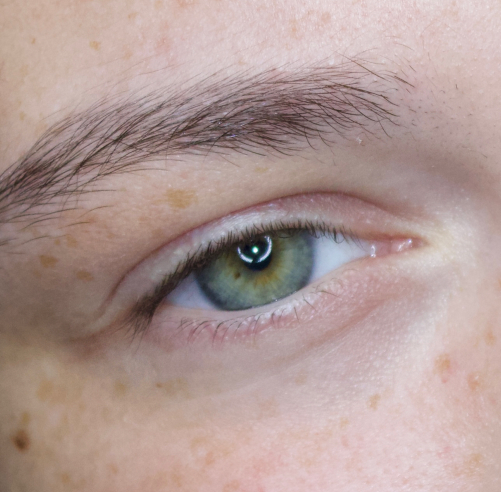 Lash Removal