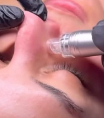 Hydrofacial at RainbeautybyHeather in BEAVERCREEK, OH