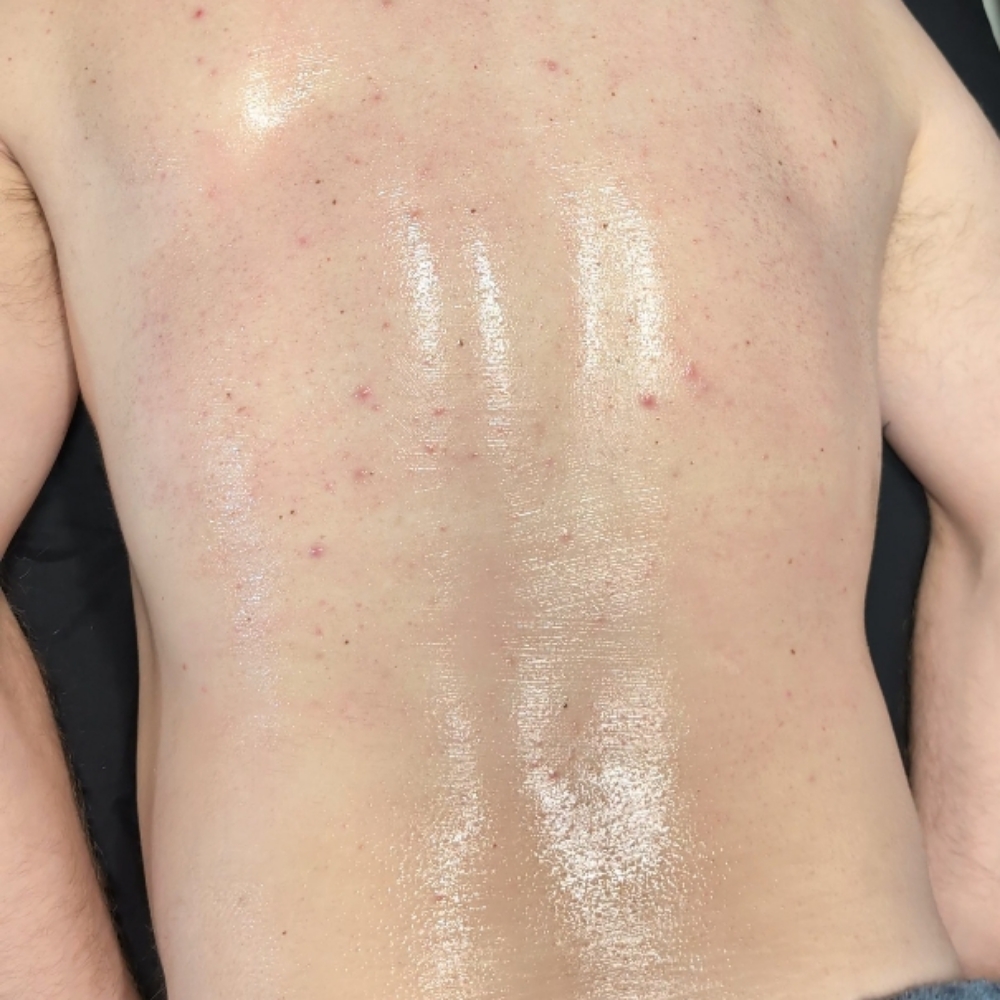 Body Treatments at Moonlit Esthetics in Minneapolis, MN