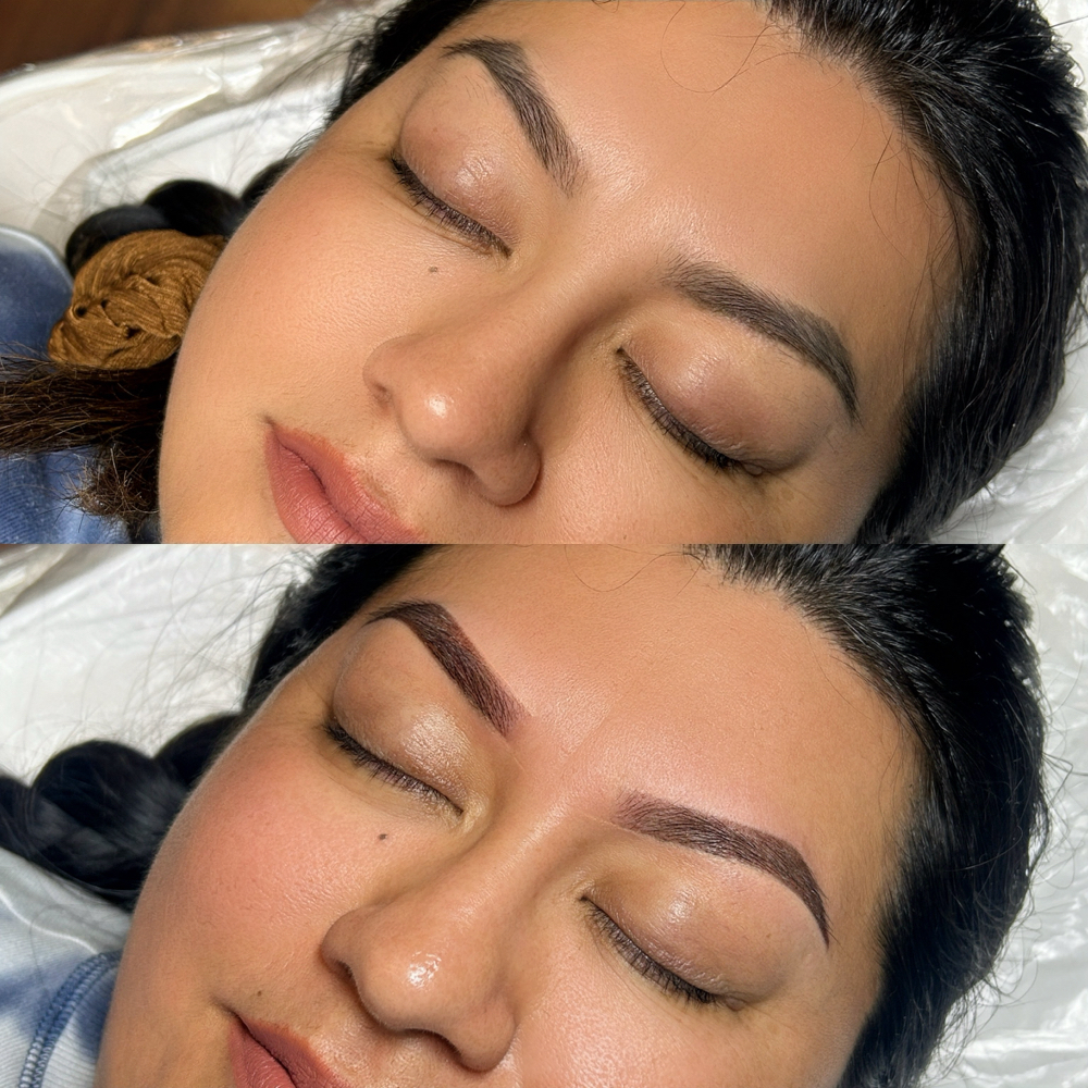 Free Phone Consultation(Microshade)