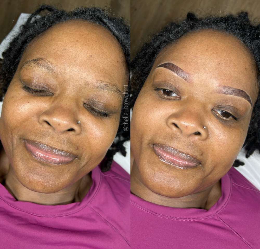 Free Phone Consultation(Microshade)