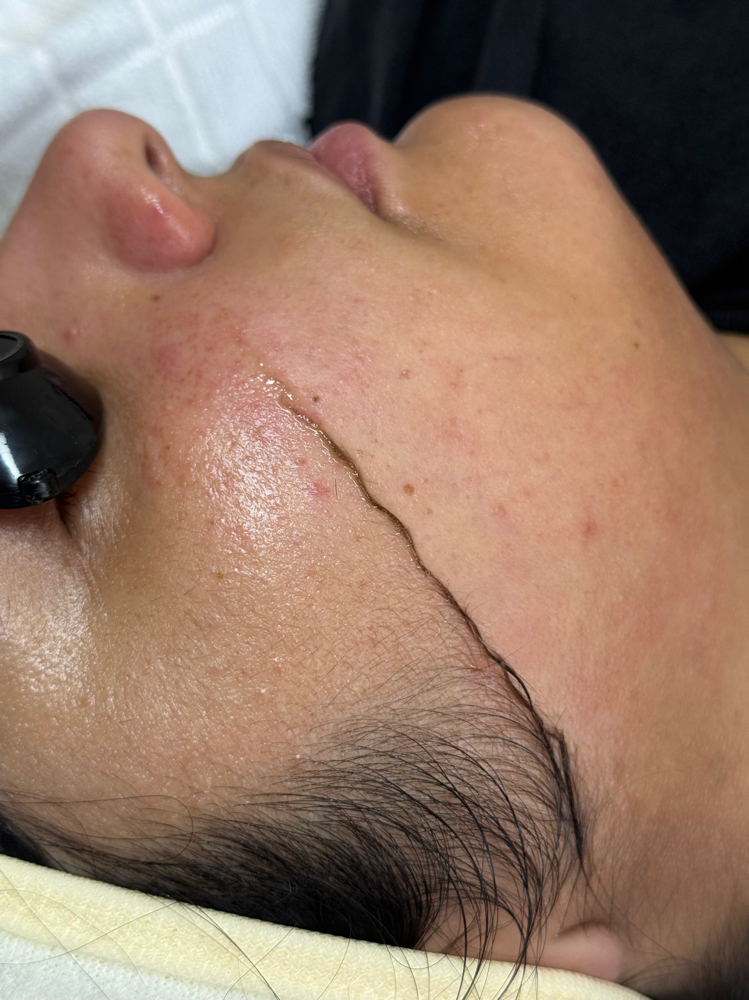Dermaplane Glow Facial