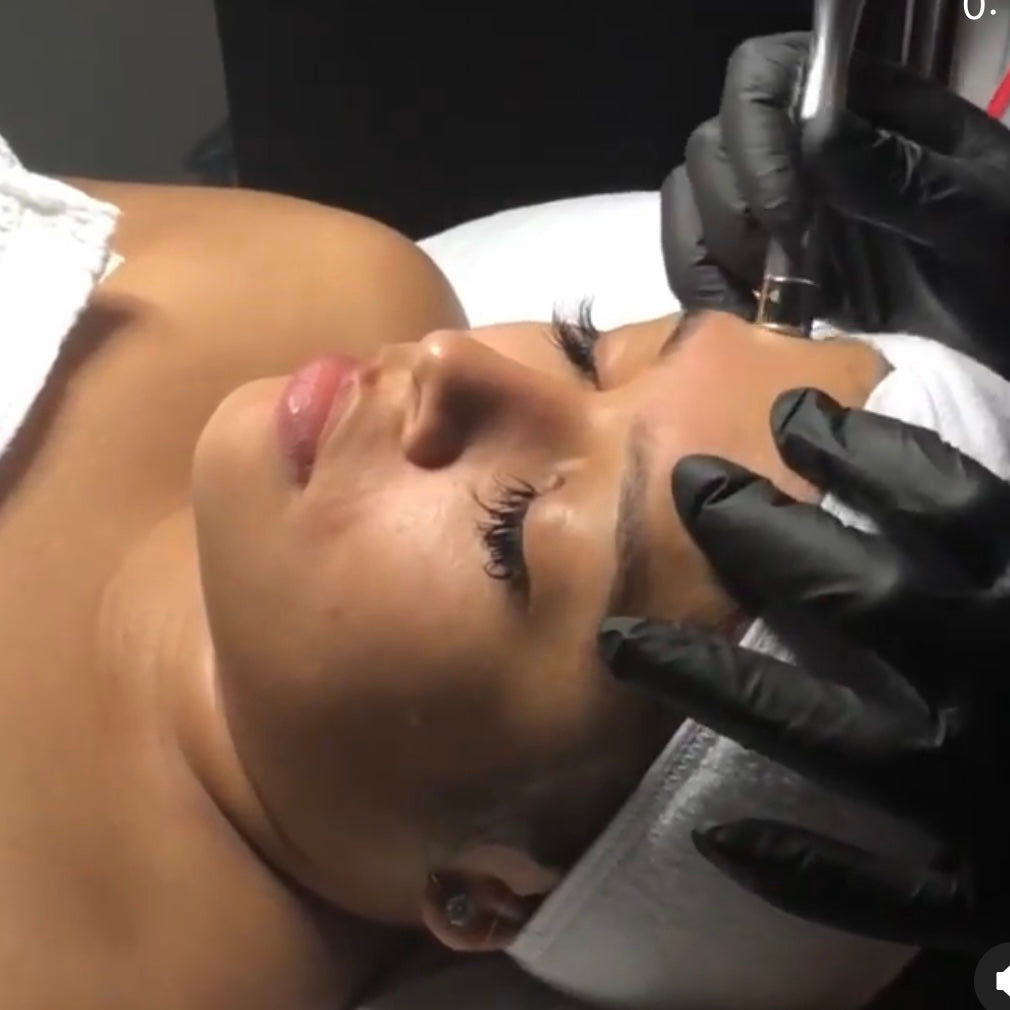 Diamond Tip Microdermabrasion- at ReBourne Aesthetics and Wellness in Ridgland, MS