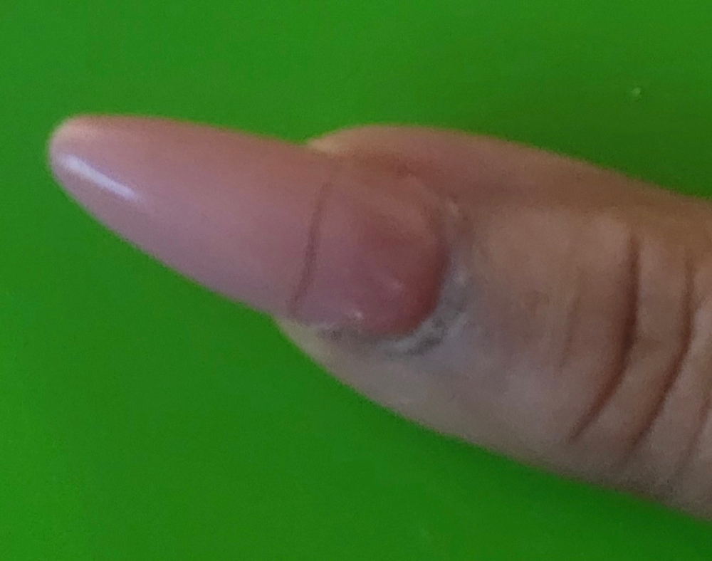 Nail Repair