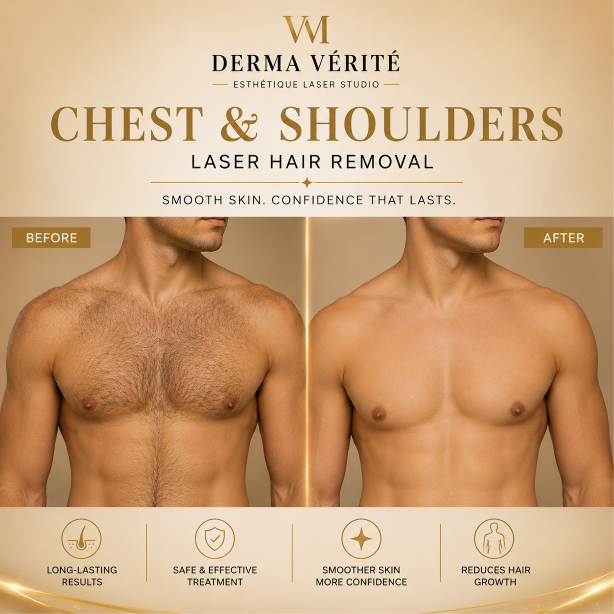 Chest Laser Hair Removal at Derma Verite Esthetique Laser Studio in Elmhurst, NY