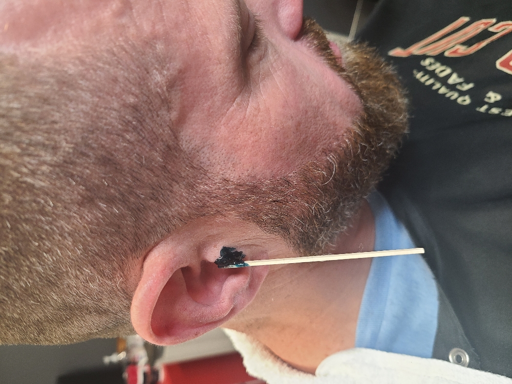 Ear Wax