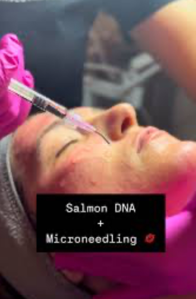 Salmon DNA 3 Sessions