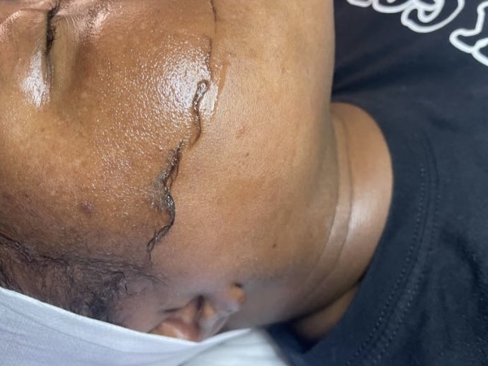 Signature Dermaplaning Facial
