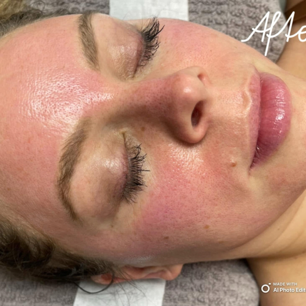 Nano-pen Microneedling Facial at Microblading By Courtney in Essexville, MI