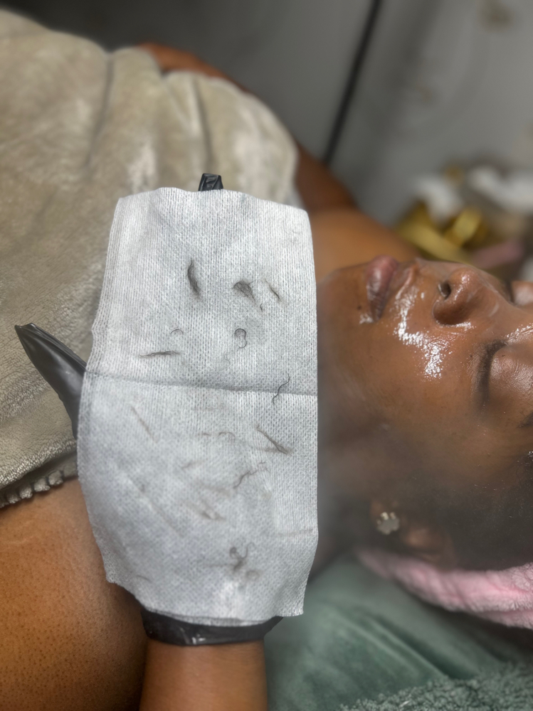 Dermaplaning Facial