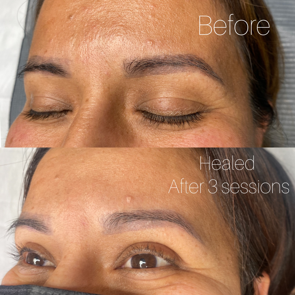Saline Removal