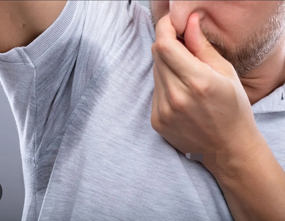Hyperhidrosis (PIT TOX)