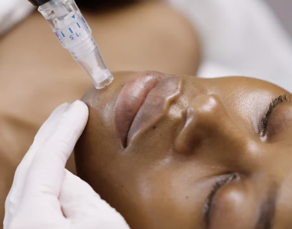 Collagen Growth Induction