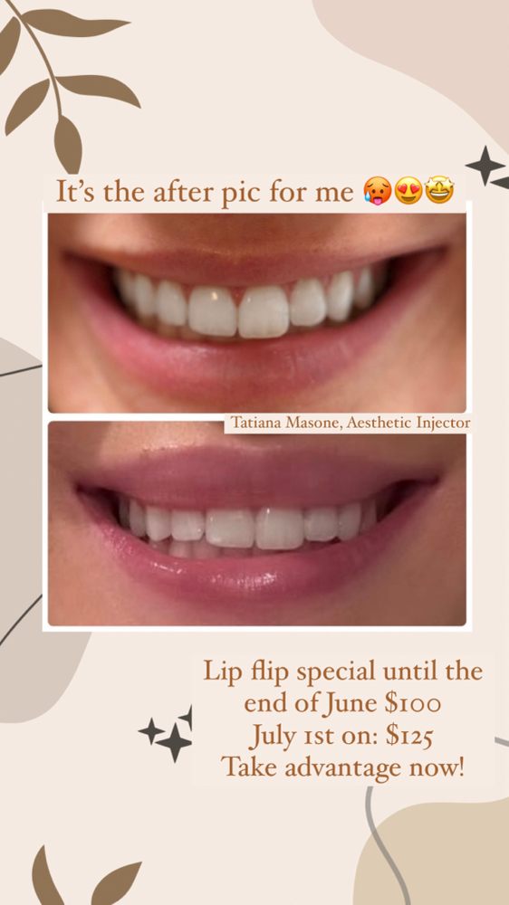 Lip Flip
