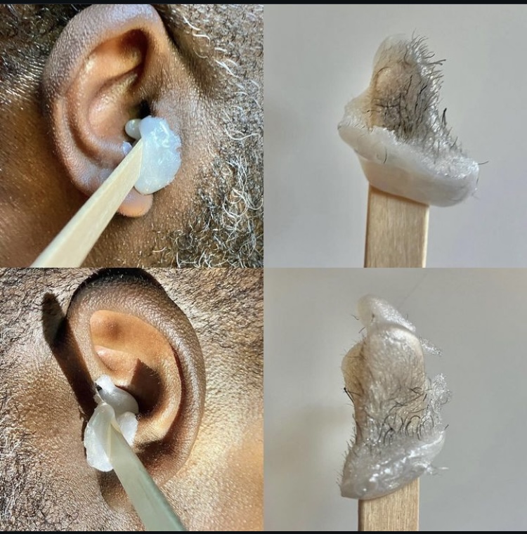 Ears