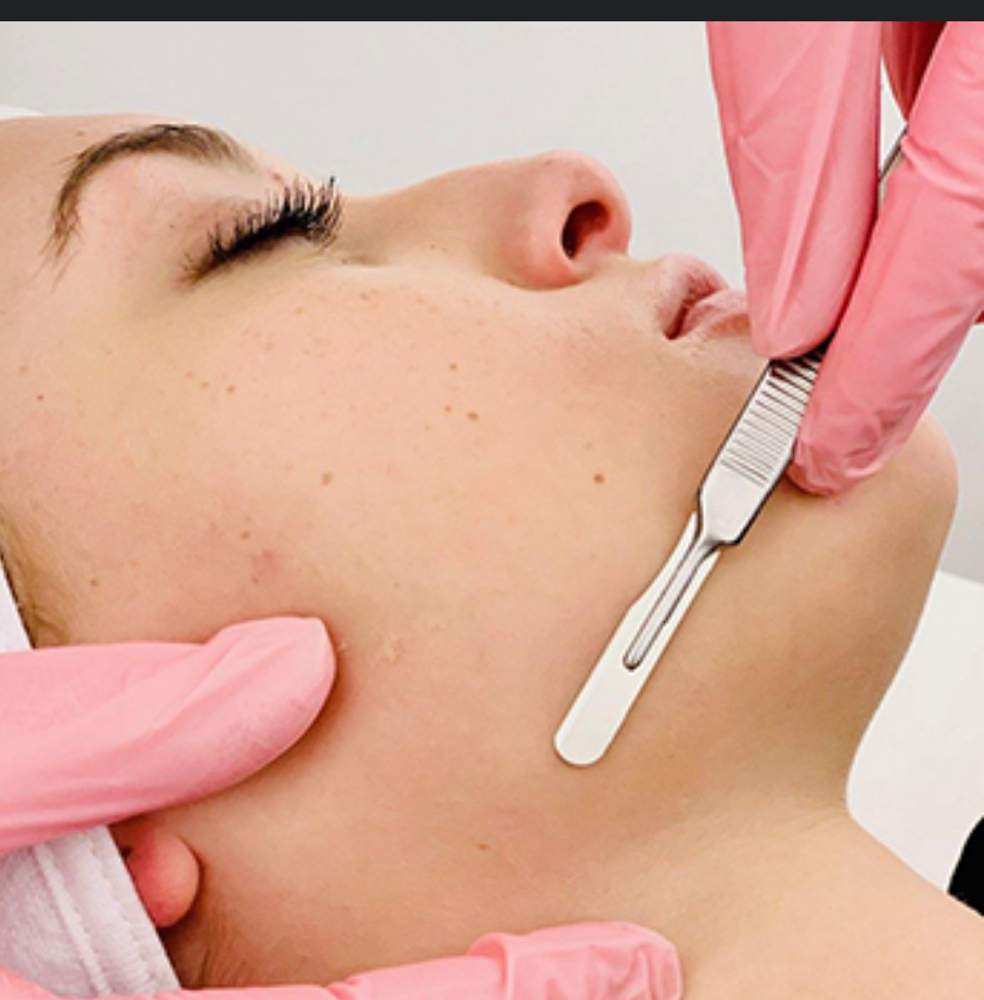 SilkSkin Dermaplaning