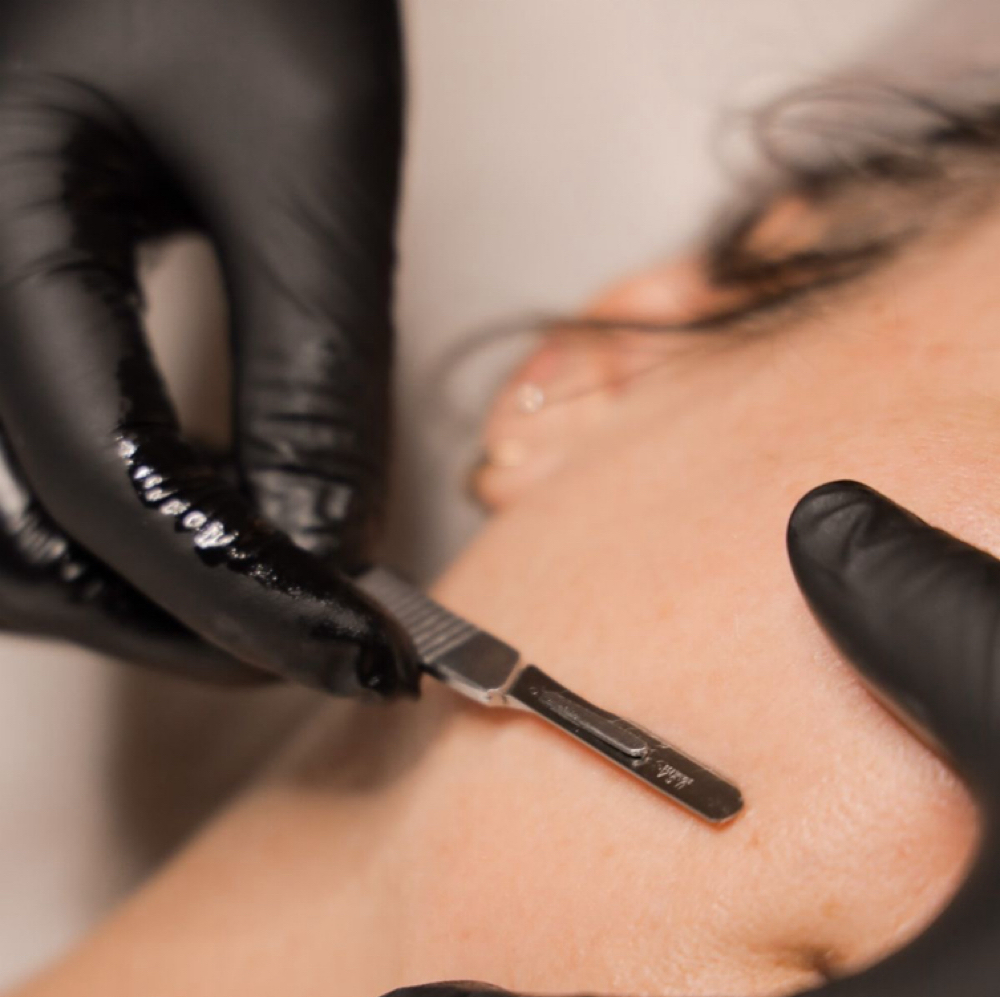 Add on- Dermaplaning at I.M.A. SPA in San Antonio, TX