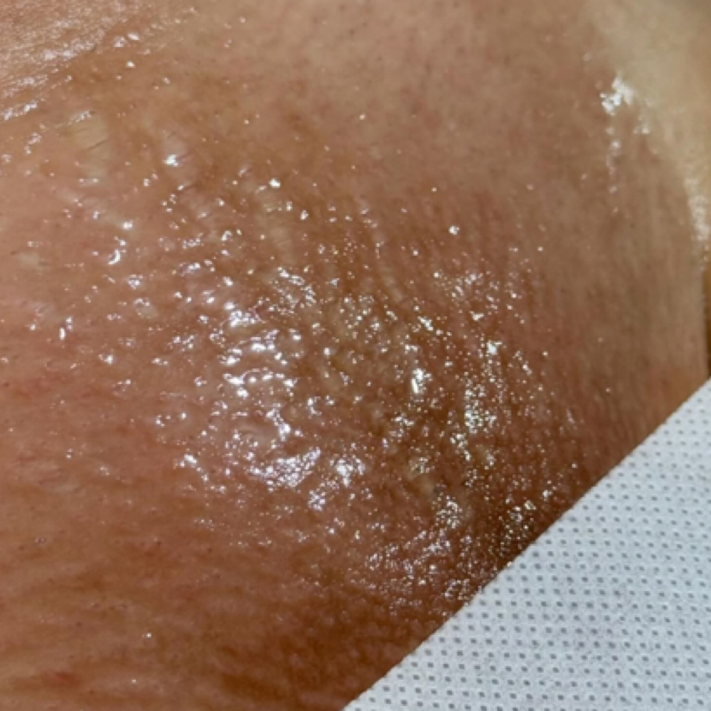brazilian wax at Madi Coca Aesthetics At The Skin Refinery in Nicholasville, KY