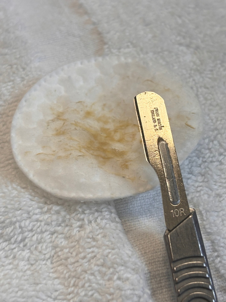 Dermaplane Facial