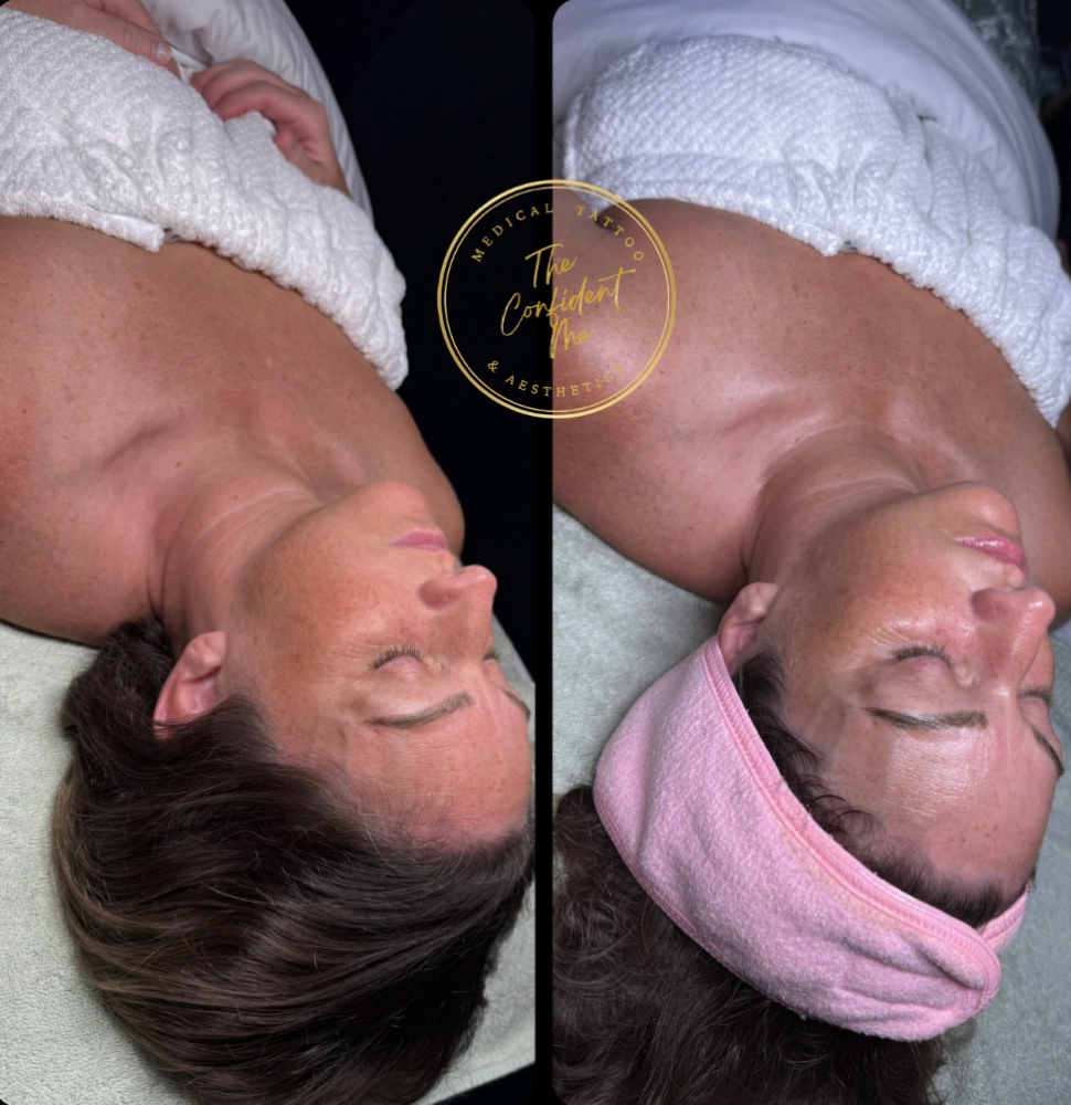 The Anti-Aging Facial