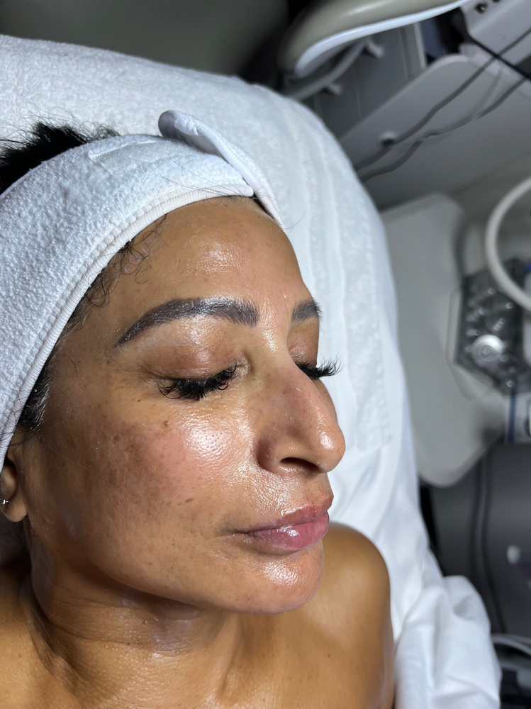 Shaved Ice Glacial Skin Treatment