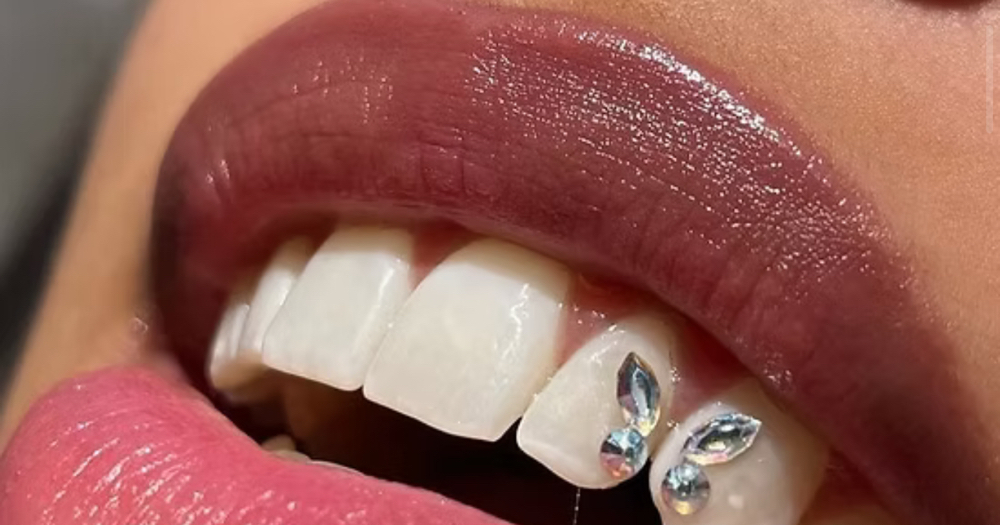 3 Tooth Gems