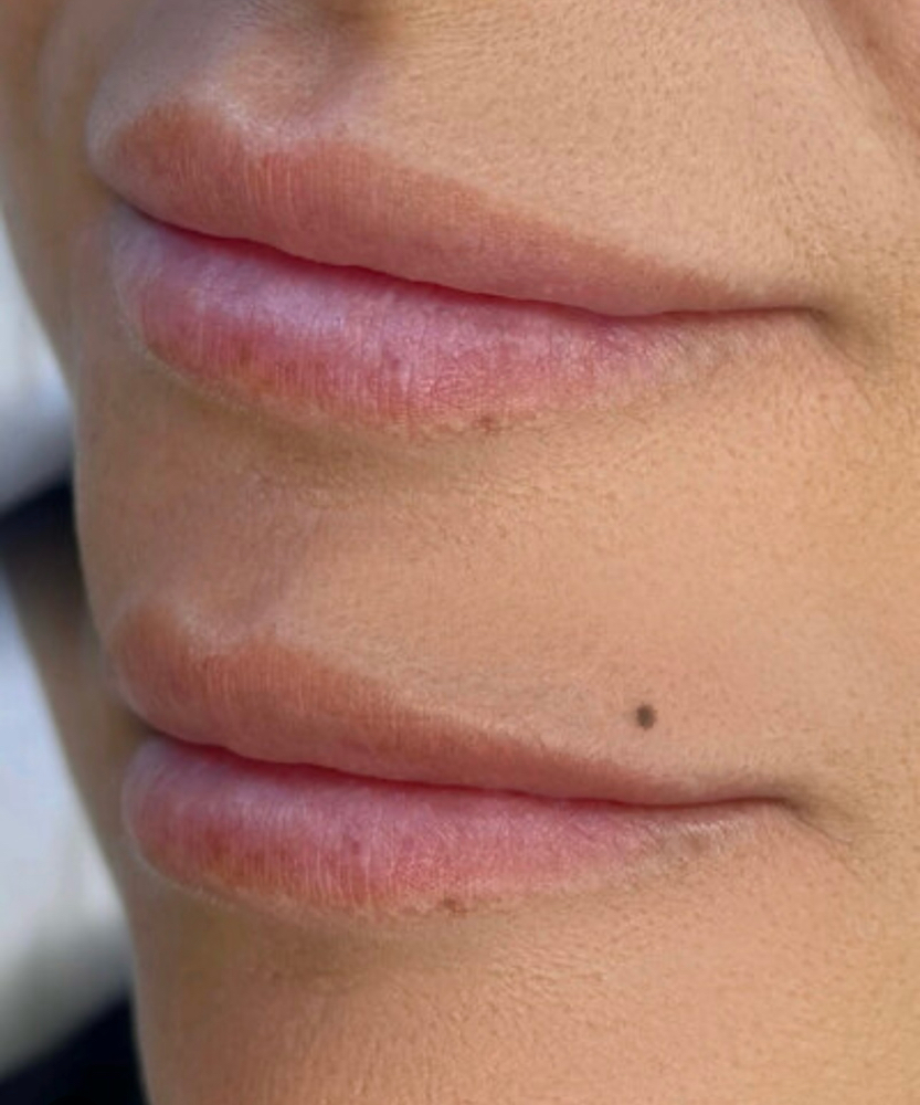 Beauty Marks ✨ (Men + Women )