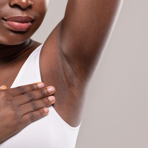 Underarms