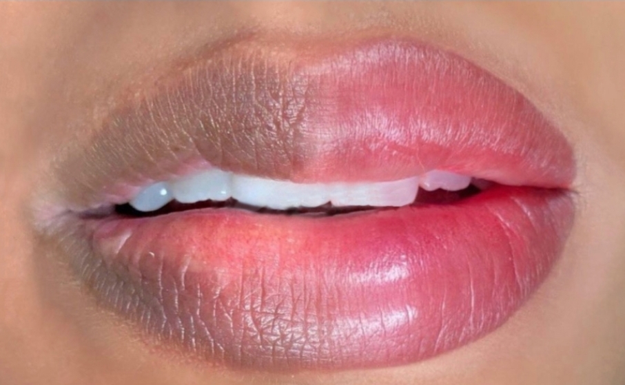 LIPS COMBO  (Neutralization+color)