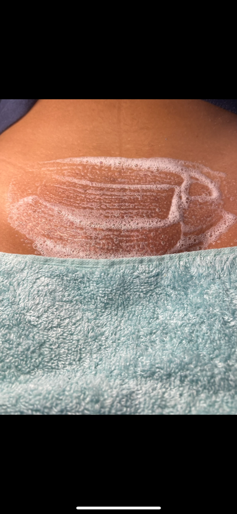Bikini Vajacial Treatment