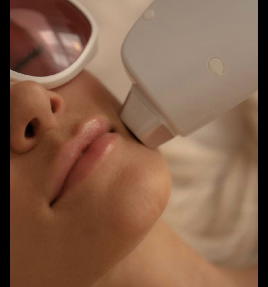 Laser Hair Removal Small Area