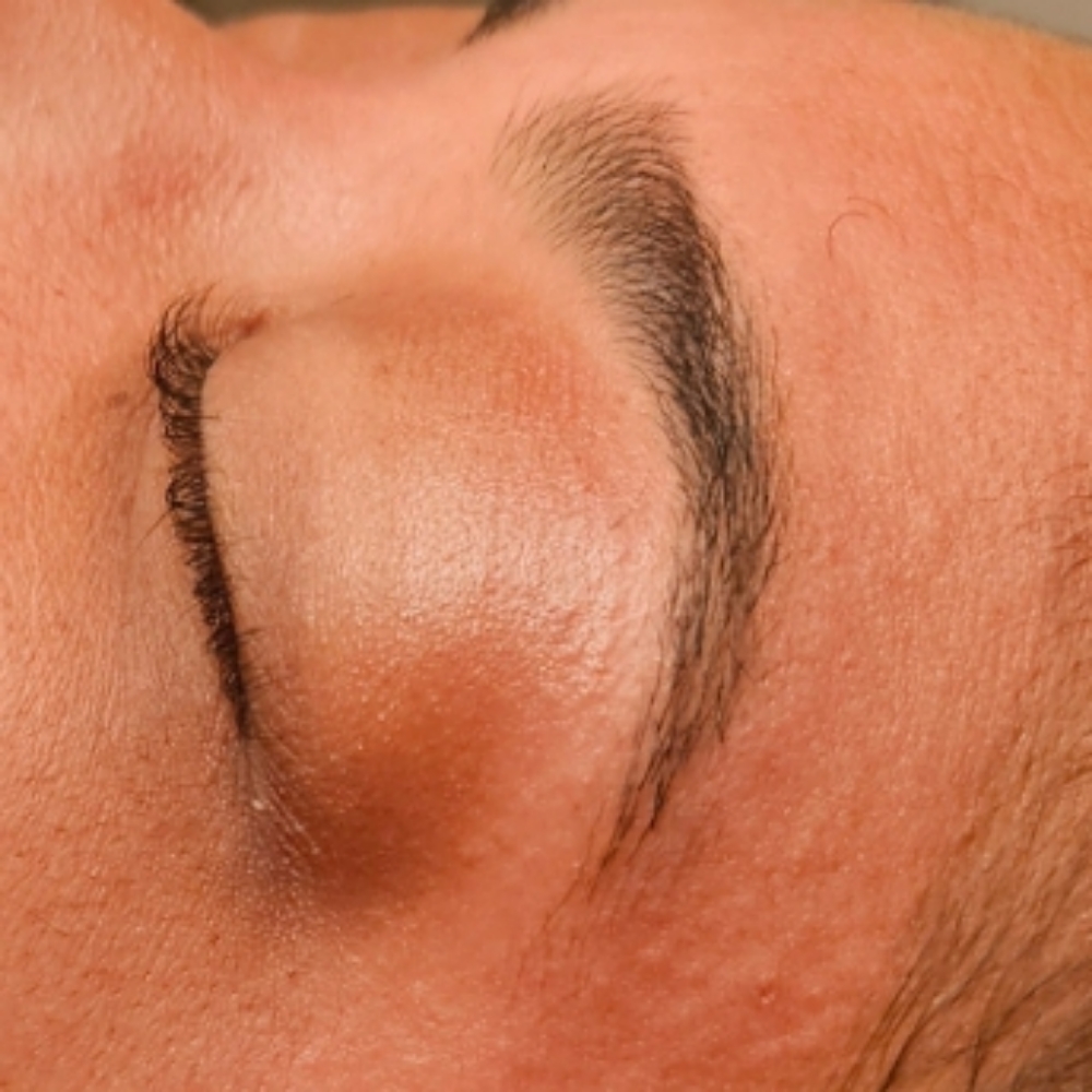 Sugaring Brow Shaping at Andersen Esthetics LLC in Tonawanda, NY