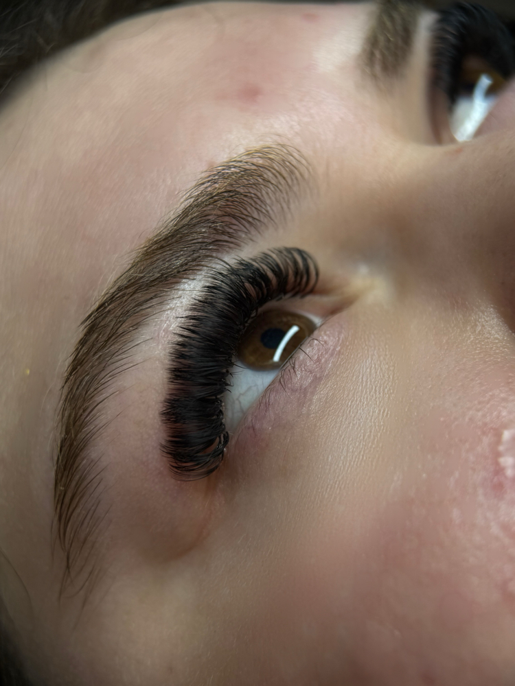 One Week Touch-Up at KES Esthetics in Fairmont, WV