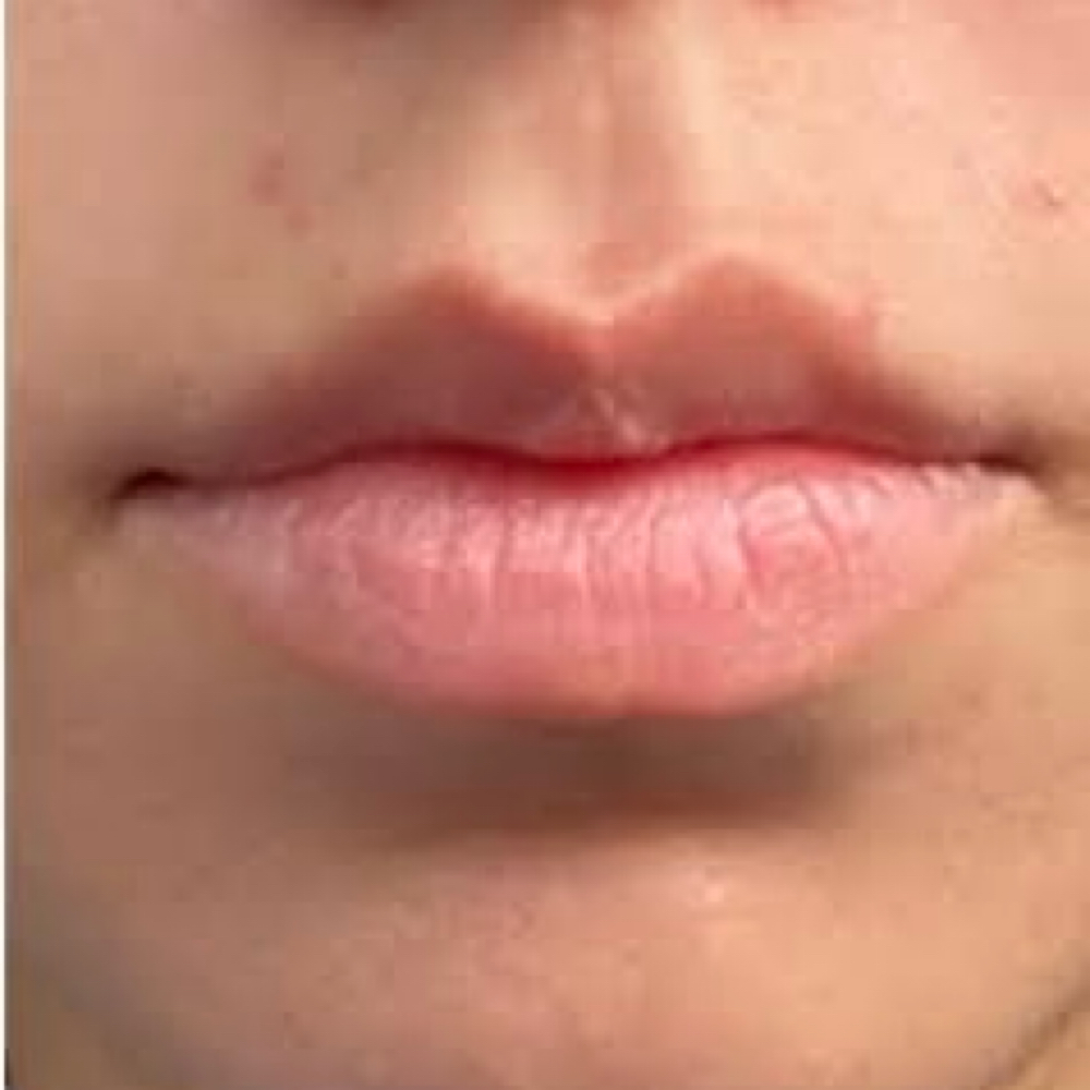 Upper Lip at iSugar Waxing Studio in Redondo Beach, CA