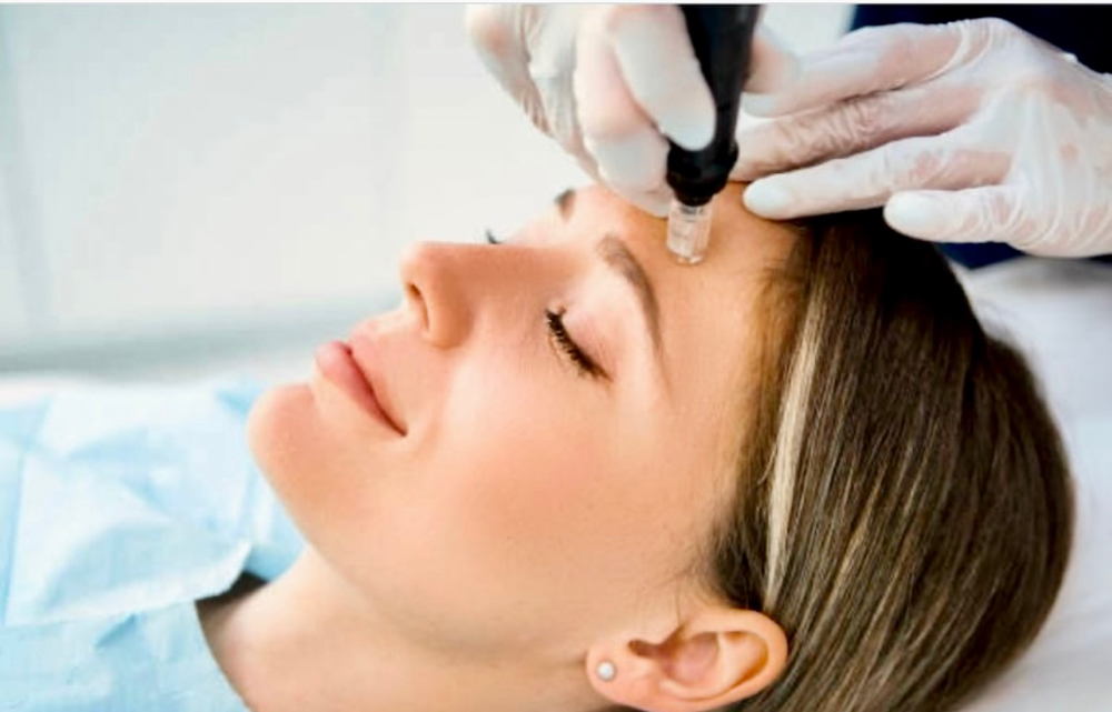 Microneedling Full Face Pkg Of 3