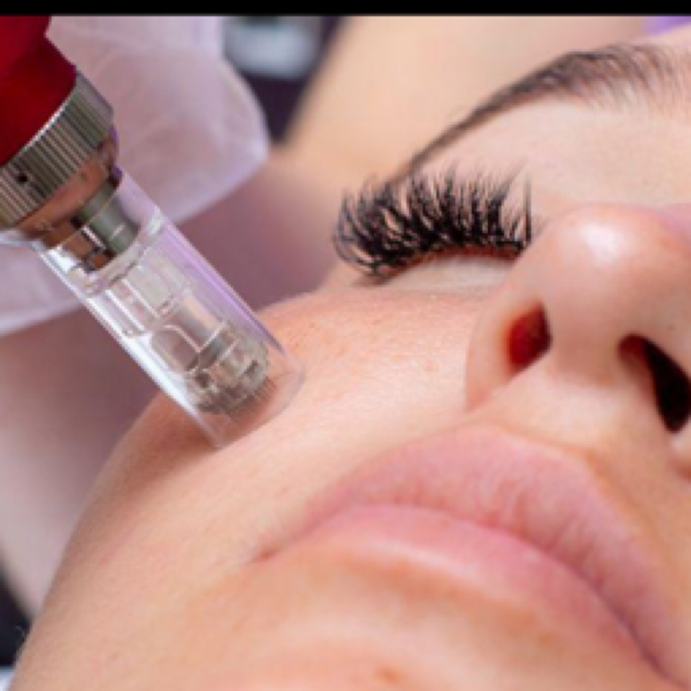 Nano Infusion - COMING SOON at Sonoran Skin Studio in Tucson, AZ
