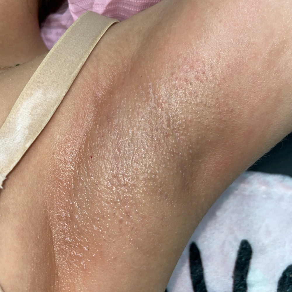 Under Arm Wax at Obaven in Reno, NV