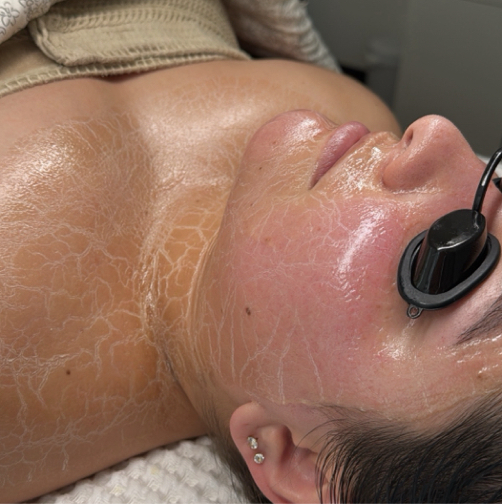 Faux-Tox Facial at Everglow Esthetics in Downey, CA