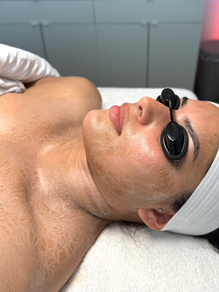 Faux-Tox Facial