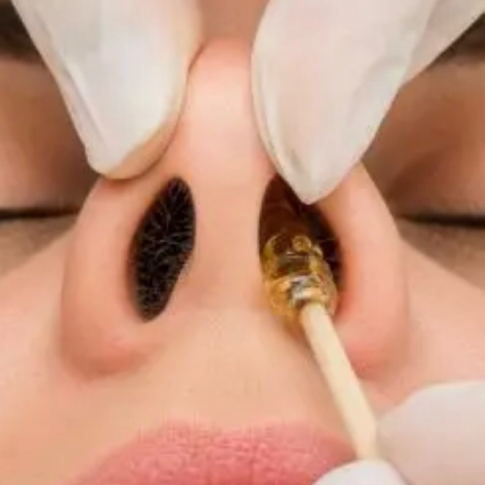 Nose at The Art of Brazilian Wax in Tampa, FL