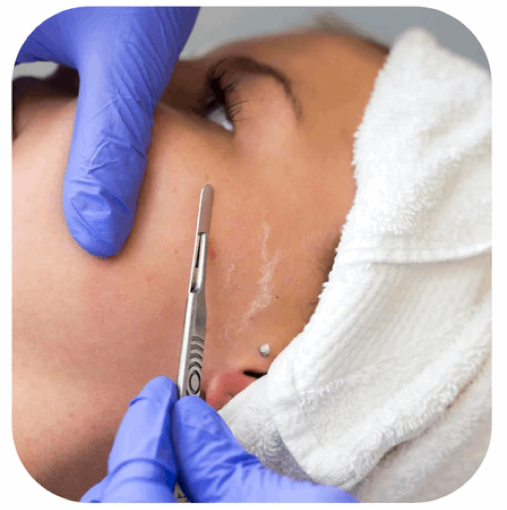 Add Dermaplaning to A Facial