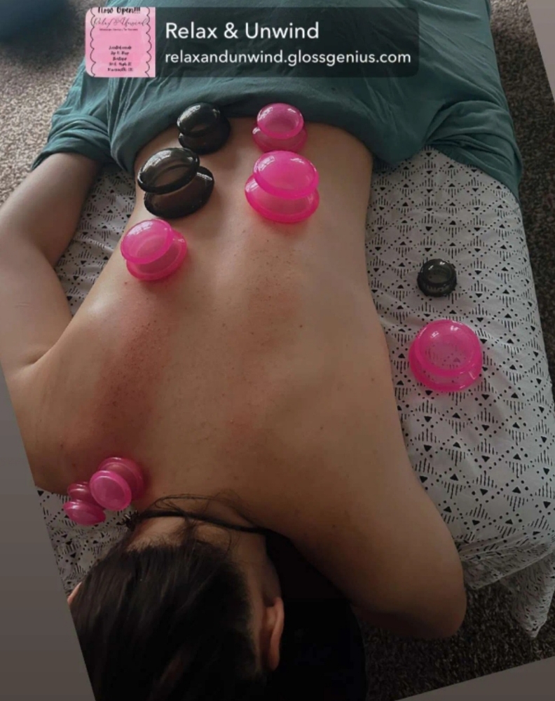 Cupping-ADD ON