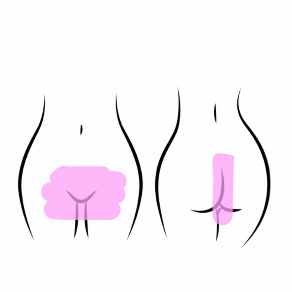 Brazilian Wax at Naked Skin by Kailey in Wichita, KS