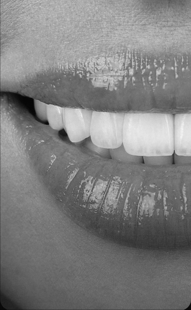 Teeth Whitening at Reflexión: Aesthetics Lounge in Fort Smith, AR