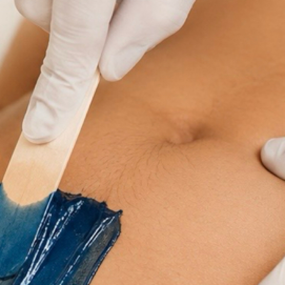 Bikini Line at Nirvana MedSpa PLLC in Charlotte, NC