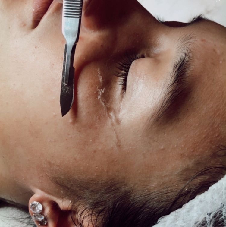 Signature Glow Facial + Dermaplane