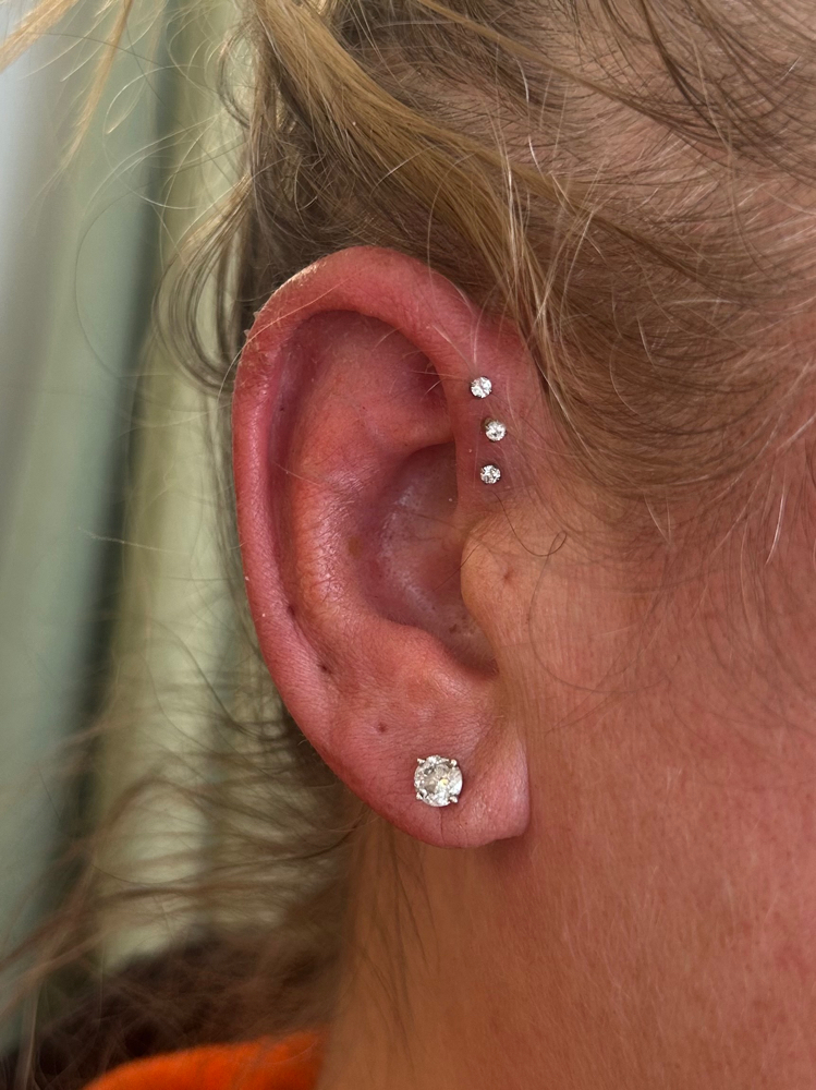 Forward Helix