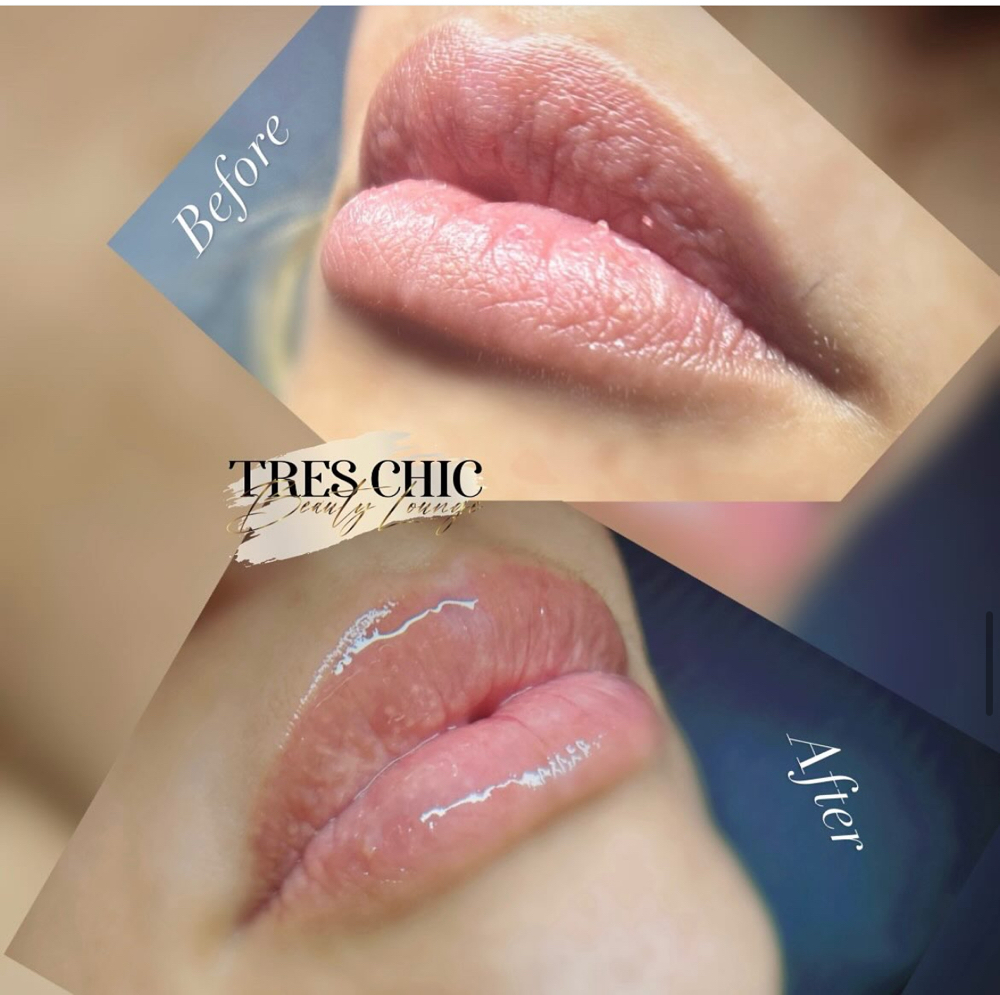 Hydragloss Lips 🫦 3 Sessions at TresChic Beauty Lounge in San Diego, CA